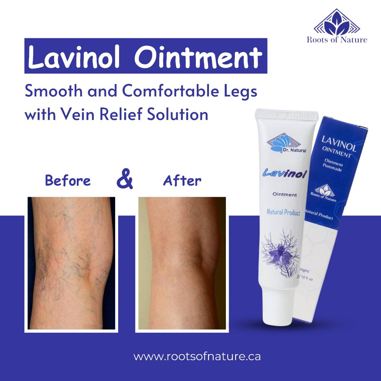 Lavinol – A Natural Ointment for Varicose Vein Relief
